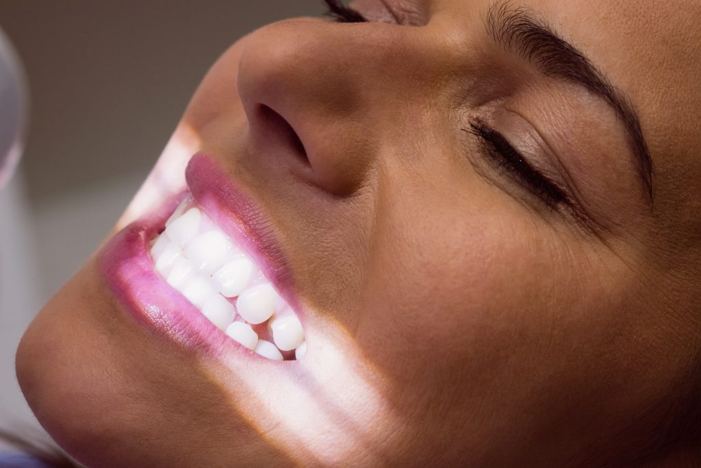 Blanchiment des dents à Bobigny : soin esthétique pour retrouver un sourire lumineux