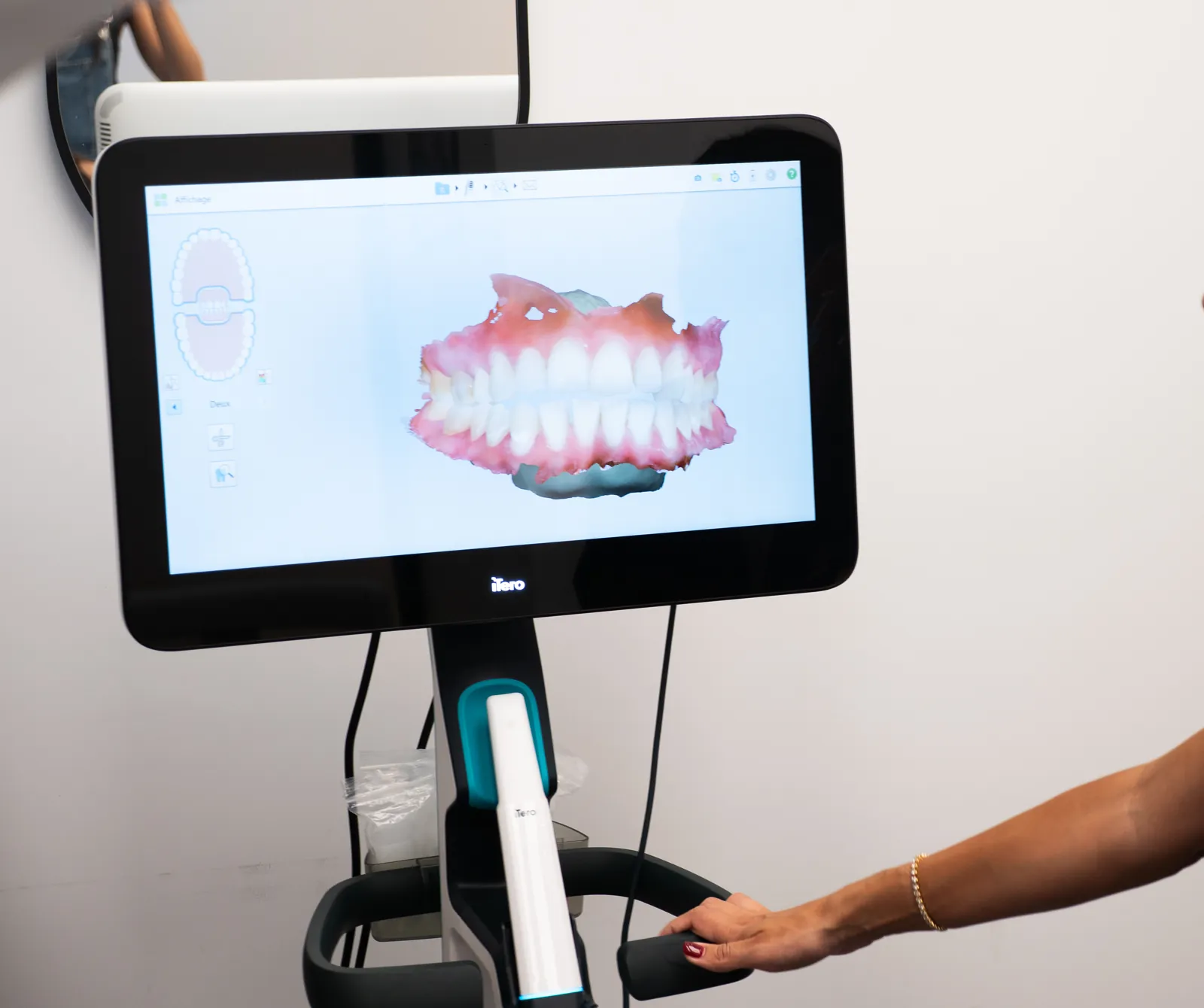 Empreinte numérique du sourire en 3D sur écran