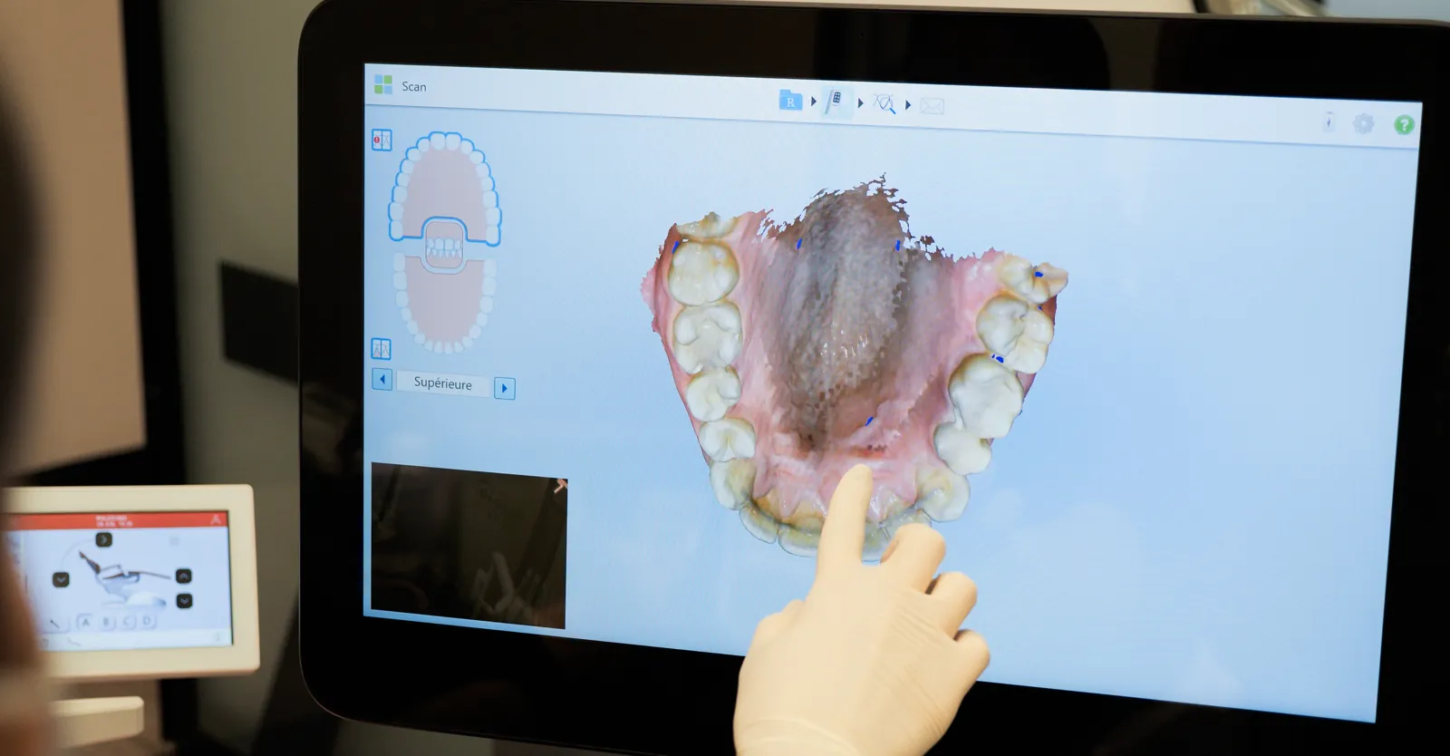 Scanner intra-oral et image 3D des dents